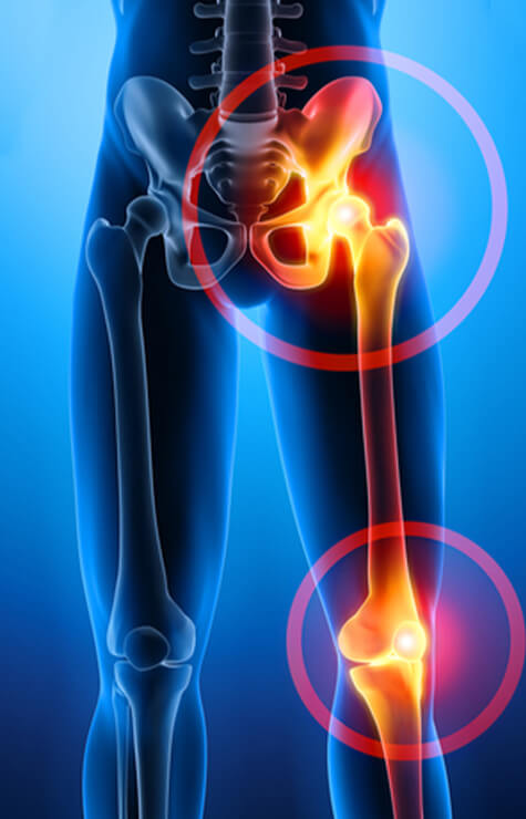 hip and knee pain locations