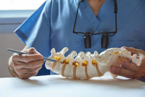 Doctor pointing at spinal discs in a vertebra model