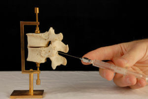 spinal surgery