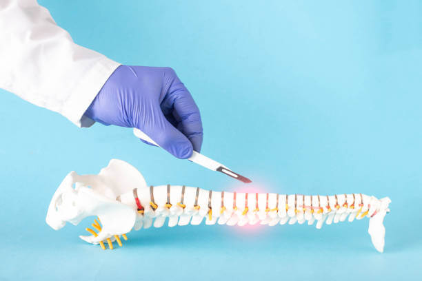 Doctor's hand with a scalpel near the mock up of the human spine on a blue background-Spine surgery concept