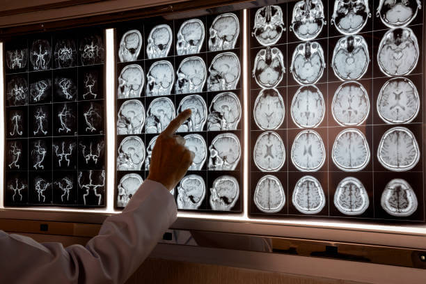 Doctor pointing at MRI of human brain on the light box