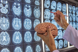 A neurosurgeon holding human brain model and pointing at brain MRI on lightbox in medical office