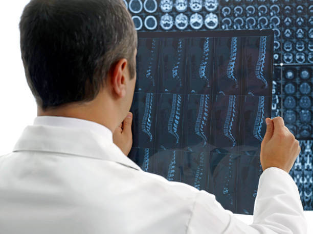 Male doctor looking at MRI Scan.