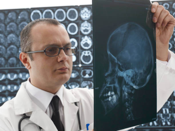 Male neurosurgeon looking x-ray.
