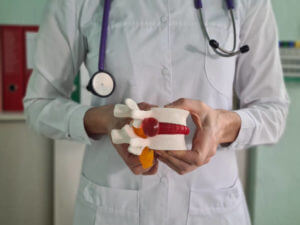 Closeup of female doctor hand with artificial disc herniation and spine model. Treatment of herniated discs and diseases of spine
