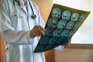 Neurosurgeon holding MRI brain in medical office