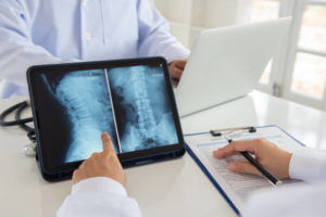 lumbar vertebrae x-ray image by mri on digital tablet screen with medical team for consult.