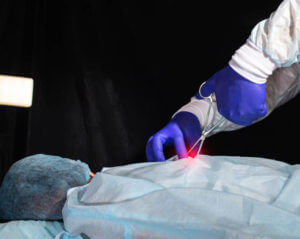 A spinal surgeon performs a hernia surgery on a patient's back. Myelopathy, copy space for text