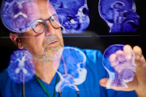 NeuroSurgeon analysing scans