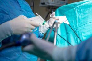 Doctors performing surgery in operating theate