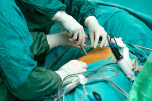 Doctors Operating Minimmaly Invasive Spine Surgery