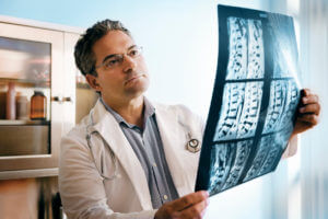 Spine Surgeon analysing patient Spine X-ray before surgery