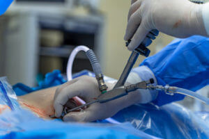 Surgeons opearyion Artificial Disc replacement surgery