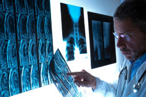 Revision spine surgery - Aurora Colorado