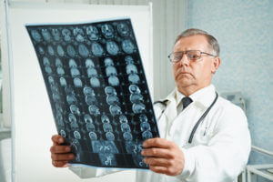 Neurosurgeon examines MRI image