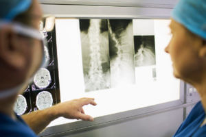 spine surgeons discussing patients x-ray and MRI scans