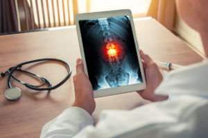 A spine surgeon is holding a digital tablet displaying an X-ray of the spine skeleton, with a stethoscope and syringe on the desk.