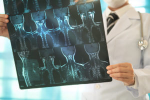 Neurosurgeon reviewing X-ray images of a patient.