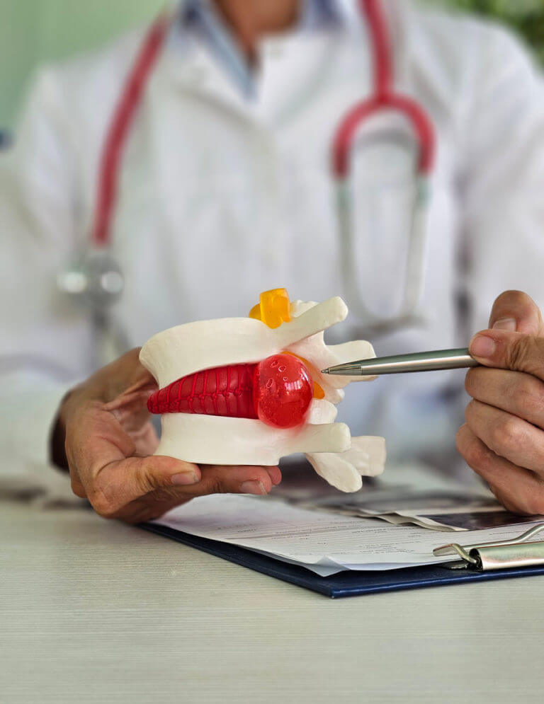 A neurologist demonstrates a mock spine with an intervertebral hernia to explain the concept of artificial discs.