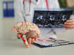 Doctor checks x-ray of brain for brain injury using ST segment scanning.