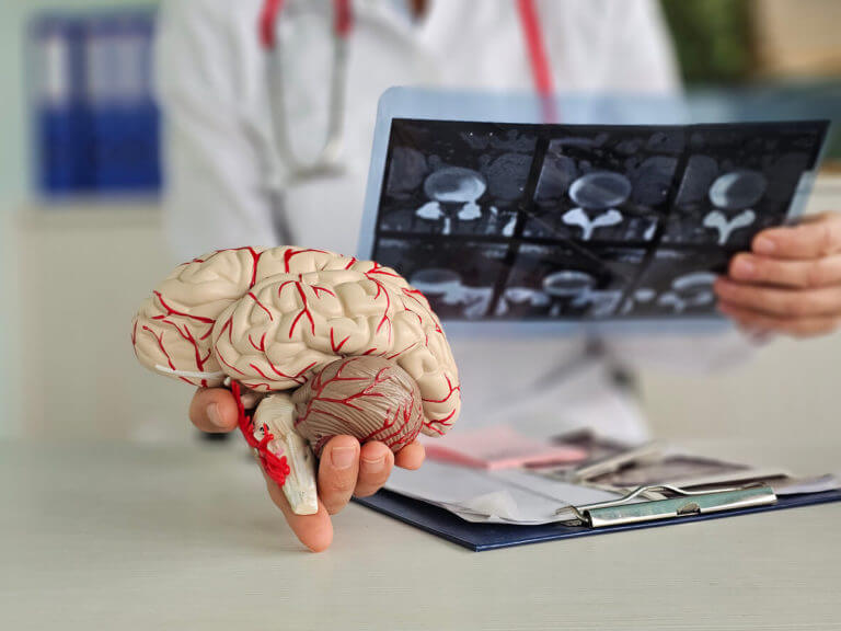 Doctor checks x-ray of brain for brain injury using ST segment scanning.